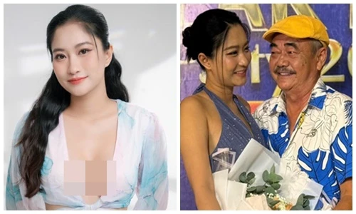 Bạn gái NSND Việt Anh mặc táo bạo hậu "dao kéo"