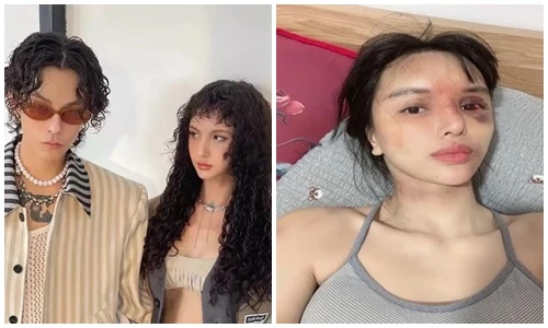 Trước Lâm Minh, nhiều mỹ nhân Việt công khai việc bị bạo hành