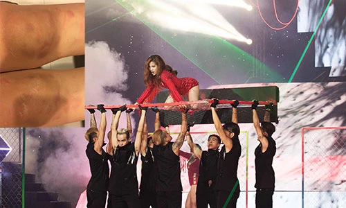 Hoàng Thùy Linh bầm dập vì quỳ gối trên hàng rào sắt