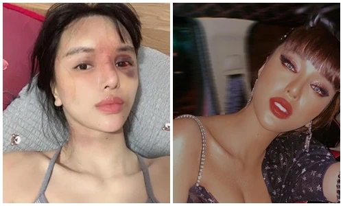 Vẻ gợi cảm của Khả Trang vừa tố bị bạo hành dã man