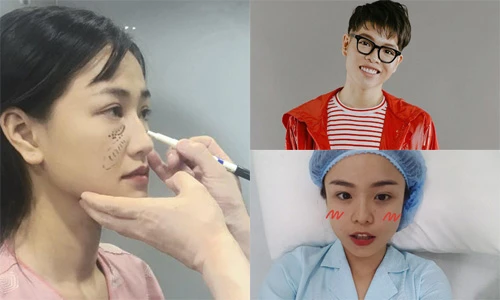Loạt sao Việt không ngại công khai phẫu thuật thẩm mỹ