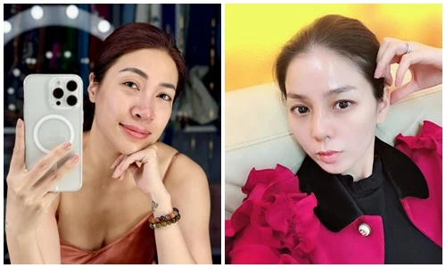 Trước Pha Lê, nhiều sao Việt bị biến chứng sau sửa mũi