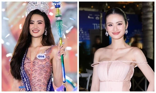 Hoa hậu Ý Nhi công khai "dao kéo" vòng một