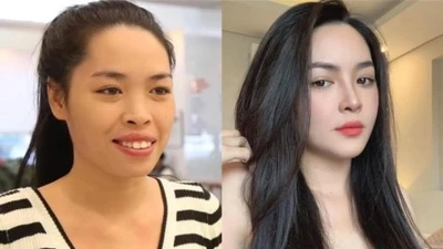 Nhan sắc hiện tại của hot girl từng 'lột xác' nhờ phẫu thuật thẩm mỹ