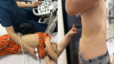 Ồn ào trại hè làng háo hức, dân mạng 9 người 10 ý
