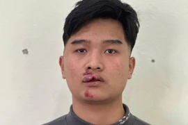 Khởi tố nam thanh niên lái xe máy đâm vào CSGT Hưng Yên