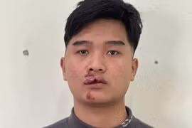 Khởi tố nam thanh niên lái xe máy đâm vào CSGT Hưng Yên