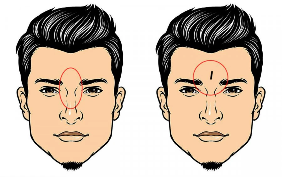 3 nét hung tướng xui xẻo đích thị là “con ghẻ” của Thần Tài