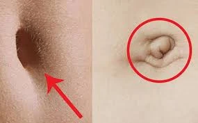 Nhìn rốn 3 giây biết ngay vận số sang hèn, phú quý đến đâu