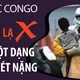 Đã xác định được căn bệnh lạ ở Congo khiến nhiều người tử vong