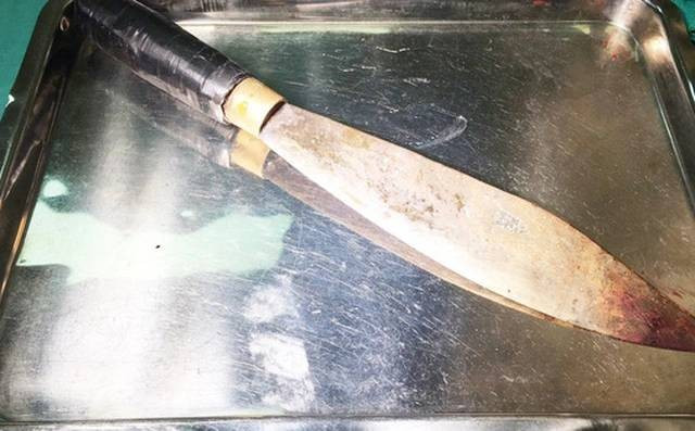 Căn cứ vào lời khai của gia đình nạn nhân, Công an tỉnh Hải Dương bước đầu nhận định, vụ án xảy ra vào khoảng thời gian từ 4h30 đến 5h30 sáng 5/12/2016. Trong khi các lực lượng đang tỏa đi khắp các ngõ ngách thôn Hòa Tô để xác minh thông tin thì gia đình nạn nhân trình báo họ phát hiện bị mất một con dao phay cũ trong bếp. (Ảnh minh họa, nguồn internet)
