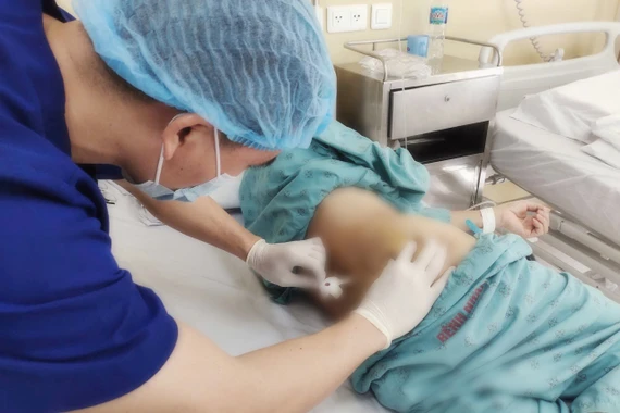 Những lưu ý trong 48 giờ đầu sau chọc hút tuỷ xương, sinh thiết tuỷ