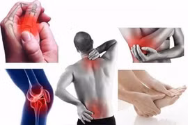 Bí quyết phòng tránh đau xương khớp mùa lạnh