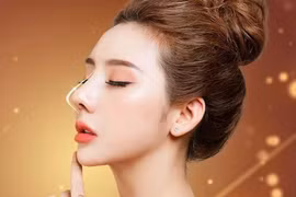 Nâng mũi không dao kéo, tiện lợi hay tiềm ẩn nguy cơ?