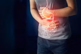 Nguy cơ tiềm ẩn cho dạ dày từ thực phẩm hàng ngày