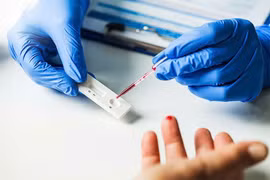 Khi nào nên tự test nhanh, phải đi khám?