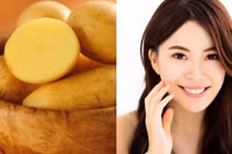 Biến làn da xỉn màu thành sáng hồng với mặt nạ khoai tây tại nhà