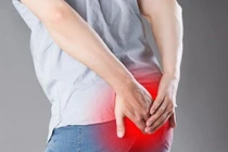 Chăm sóc bệnh trĩ tại nhà đúng cách tránh biến chứng