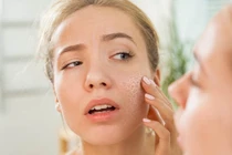 Nước ép giúp da tươi trẻ, chống lão hóa trong mùa hanh khô