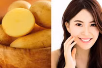 Công thức làm đẹp da từ khoai tây đơn giản mà hiệu quả bất ngờ