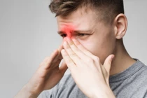 Nghẹt mũi, đau họng đi khám phát hiện... u hốc mũi trái