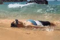 "Đu trend" nằm trên cát, nữ du khách phải vội tìm bác sĩ