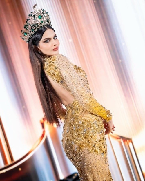 Người đẹp cao 1m78, có số đo ba vòng 81-61-91 cm. Ảnh: Instagram Rachel Gupta.