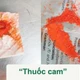 Bôi thuốc cam chữa sẩn ngứa bé 5 tuổi ngộ độc chì
