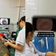 Đau nhói thực quản sau ăn do dị vật xương cá mắc tại cổ