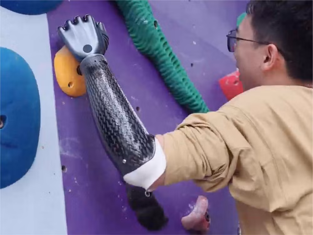 Một bước tiến mang tính đột phá trong lĩnh vực công nghệ y sinh vừa khiến cộng đồng khoa học toàn cầu chú ý khi mẫu cánh tay giả Revo2 chứng minh khả năng “đọc” ý định vận động của con người và phản hồi gần như tức thì, biến những điều từng chỉ xuất hiện trong khoa học viễn tưởng thành hiện thực.