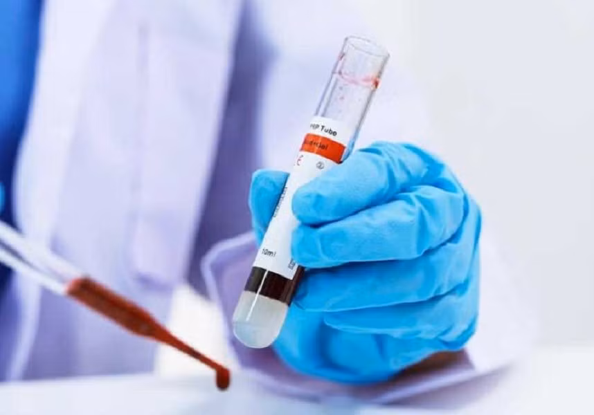 Loại máu này có thể bảo quản ở nhiệt độ phòng mà không cần làm lạnh như máu thật.