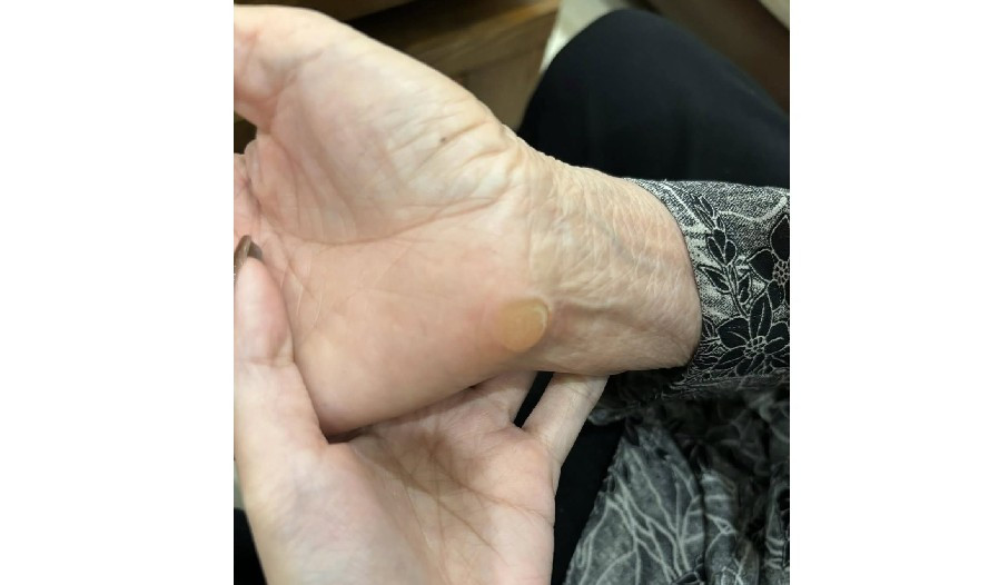 Thay vì là dấu vết của lao động vất vả, những vết chai ấy lại đến từ niềm đam mê game bắn bi Zuma suốt gần hai thập kỷ.