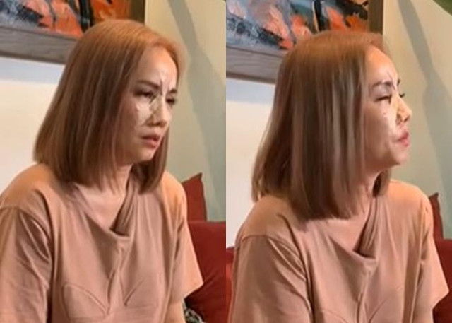 Hoàng Yến đi chữa mũi sau cú đấm "trời giáng" từ chồng cũ - Hình 4 Hoang Yen di chua mui sau cu dam