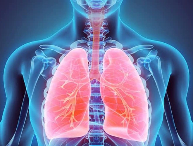 Mắc bệnh viên phổi "dễ như chơi" bởi lý do thường gặp
