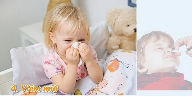 7 bệnh nguy hiểm trẻ nhỏ dễ mắc phải vào mùa đông