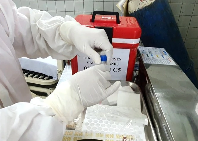 Cận cảnh quy trình lẫy mẫu xét nghiệm COVID-19 cho bác sĩ cấp cứu