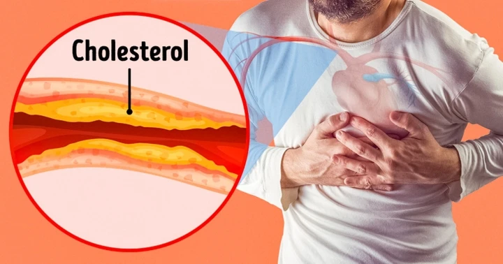 7 dấu hiệu tắc động mạch cực nguy hiểm thường bị bỏ qua