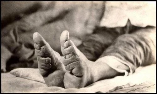 Chiêu hành xác làm đẹp kinh dị nhất lịch sử loài người