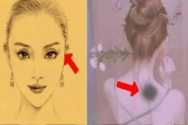 4 vết bớt Đức Phật đánh dấu, dự báo số mệnh cát tường