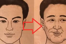 Nhận diện 4 đặc điểm khuôn mặt “báo hiệu” số kiếp long đong