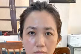 Con dâu dùng vàng giả tráo 280 chỉ vàng thật của cha mẹ chồng