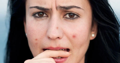 Nếu có dấu hiệu này, bạn hãy đi khám ung thư da