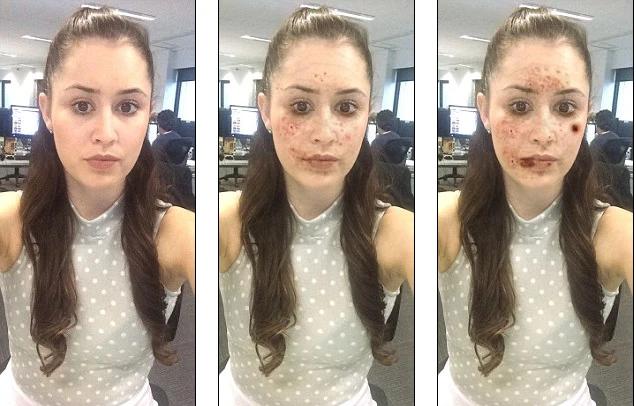 Hãi hùng khuôn mặt bị phá hủy do nghiện ma túy