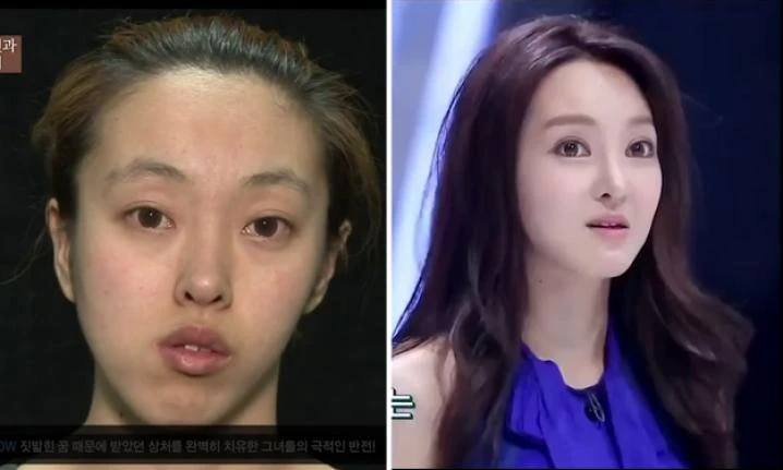 Công cuộc "lột xác ngoạn mục" của gái xấu xứ Hàn