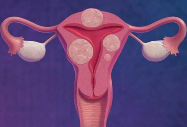 Ra máu đen khi quan hệ cảnh báo nguy hiểm gì?