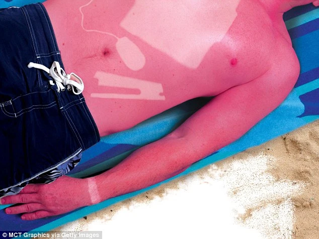 Hiểm họa rùng mình từ mốt xăm cháy nắng đang sốt điên đảo