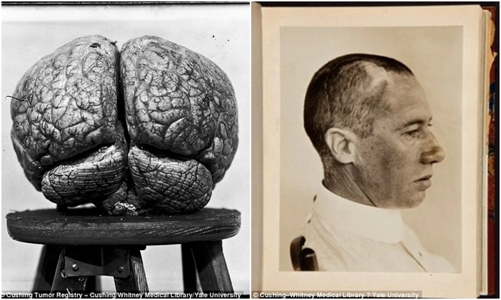 Đột nhập hầm bí ẩn của cha đẻ ngành phẫu thuật não 