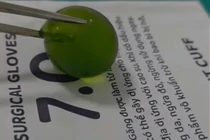 Cháu bé 13 tuổi nuốt phải hạt nở được cứu kịp thời