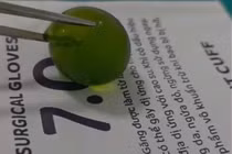 Cháu bé 13 tuổi nuốt phải hạt nở được cứu kịp thời