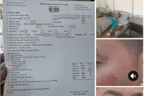 Điều tra vụ Hiệu trưởng và giáo viên xô xát trong tiệc liên hoan 20/11